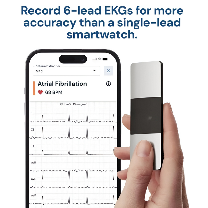 AliveCor KardiaMobile 6-Lead Personal EKG Monitor