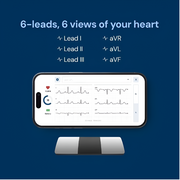 AliveCor KardiaMobile 6-Lead Personal EKG Monitor
