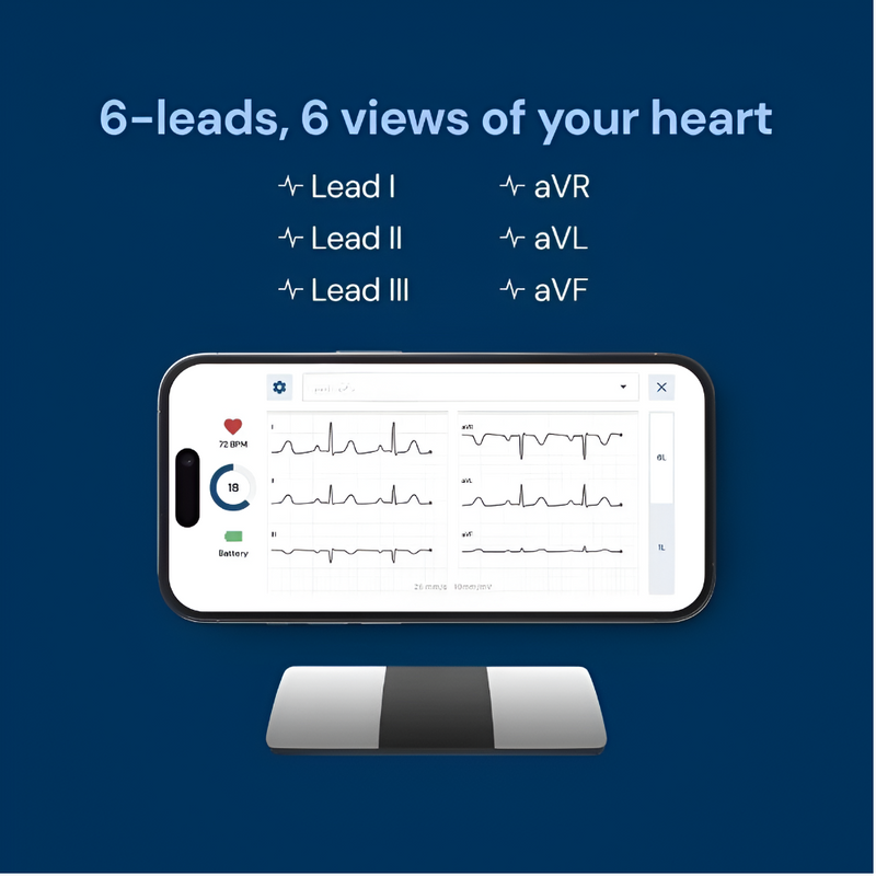 AliveCor KardiaMobile 6-Lead Personal EKG Monitor